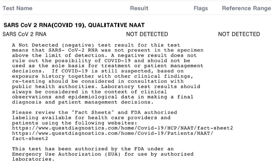SARS CoV 2 RNA test results